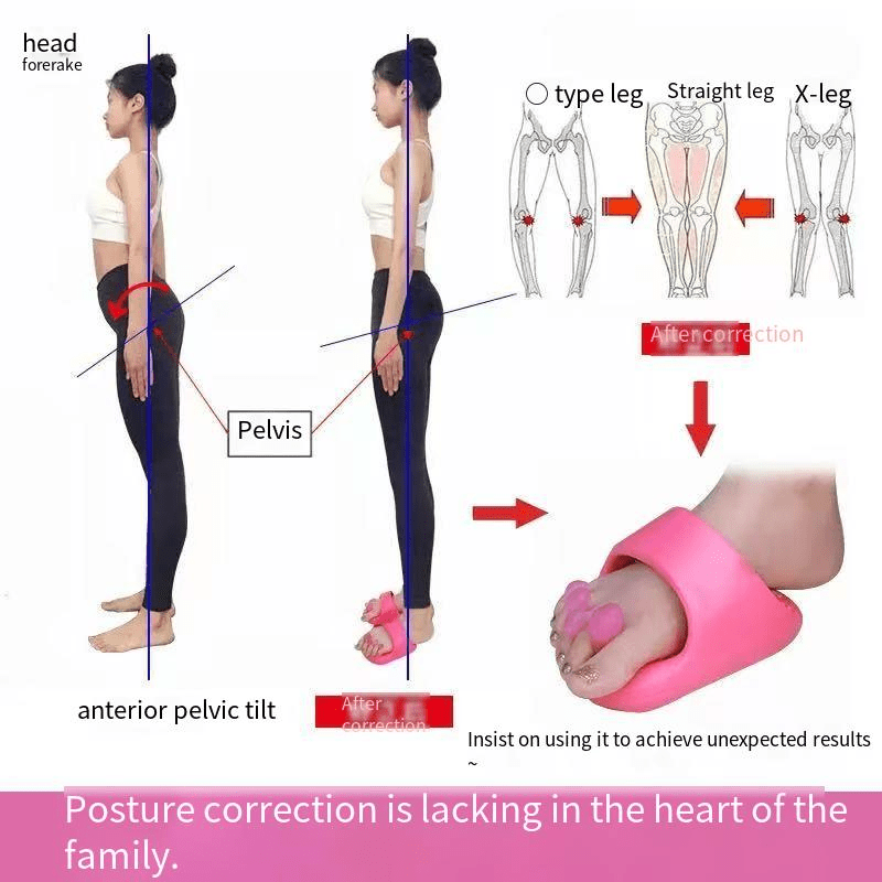Unisex Adjustable O-Leg & X-Hoop Leg Corrector Slippers - Posture, EVA Material for Heel to Toe Correction, Fallen Arches & Varus Deformity, Pink Slimming Design for Adults,, Slimming Footwear, Breathable Comfort